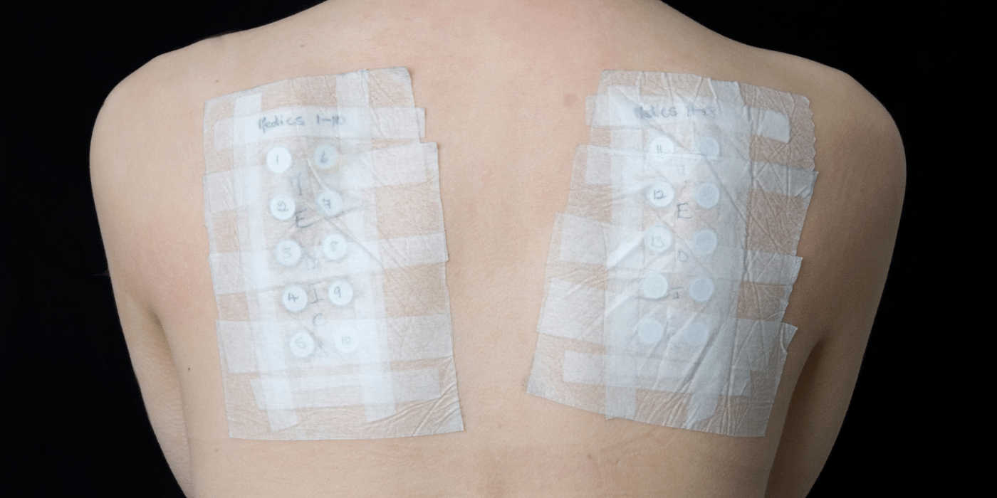 patch test justkosme aqalili
