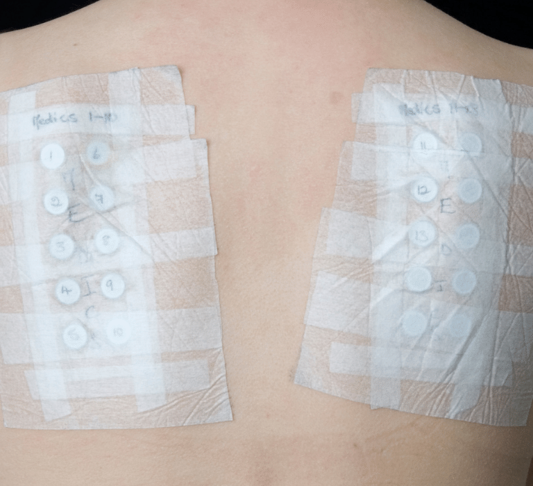 patch test justkosme aqalili