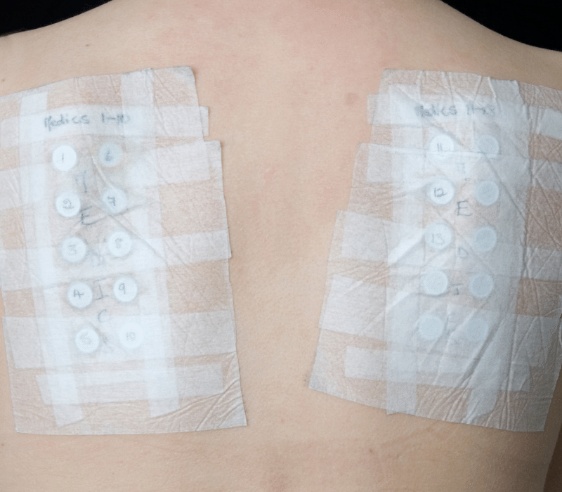 patch test justkosme aqalili